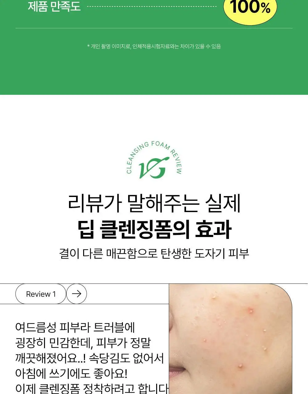 [여드름기능성/약알카리성] 비건이펙트 청보리 LHA 딥클렌징 폼 165ml 상세페이지 14
